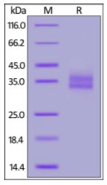 Rhesus macaque EpCAM, His Tag on SDS-PAGE under reducing (R) condition. The gel was stained overnight with Coomassie Blue. The purity of the protein is greater than 95%.